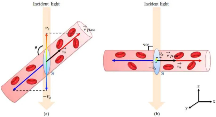 Fig.  4.  Scheme  of  Doppler  OCT  (a)  diagonal  vessel,  (b)  horizontal  vessel.