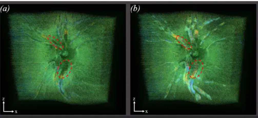 Fig. 8.  A  Result  of Volume  Rendering. (a)  Original Volume  Image,  (b)  Vessel  Reconstructed  using our  method