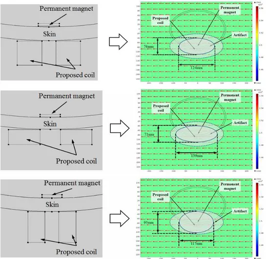 Fig.  11.  MRI  scan  for  verifying  performance  of  the  proposed  coil  system.