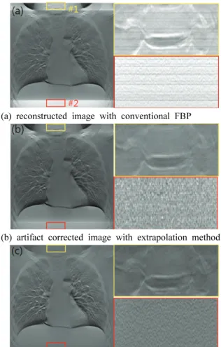 Fig. 5. ROI according to the three different simulated  reconstructed images.
