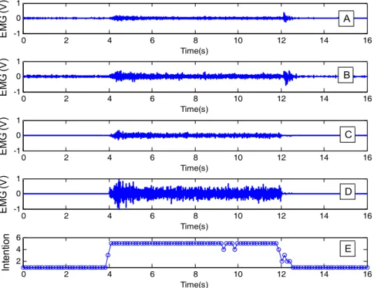 Fig. 10. Intention detection corresponding to EMG signals during wrist flexion motion, A: EMG signal from extensor  carpi ulnaris, B: EMG signal from extensor digitorum, C: EMG signal from flexor digitorum superficialis, D: 