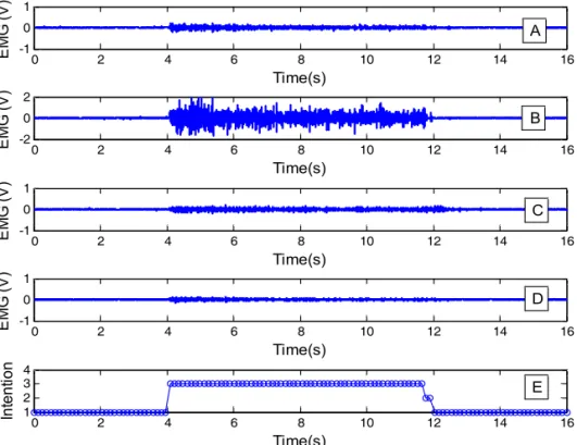 Fig. 8. Intention detection corresponding to EMG signals during ulnar deviation motion, A: EMG signal from extensor  carpi ulnaris, B: EMG signal from extensor digitorum, C: EMG signal from flexor digitorum superficialis, D: 