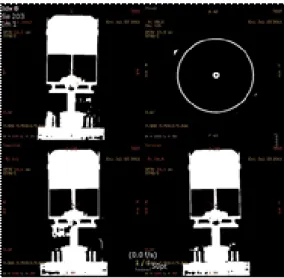 Fig.  2.  CT  radiogram  of  the  detector  system.