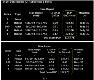 Fig.  2.  Image  of  DLP  table  for  scan  dose  is  displayed. 