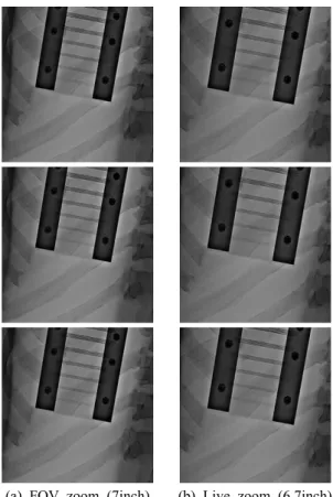 Table  1.  DAP  and  reference  air  kerma  according  to  varying  frame  rate  and  zooming  modes  of  Cine  acquisition