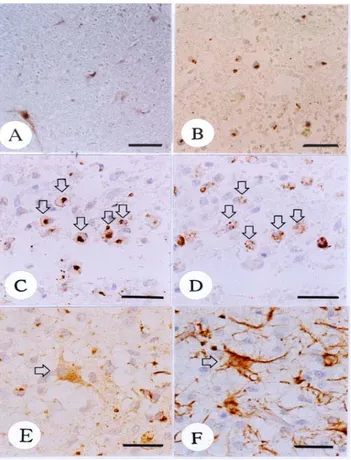 Figure  3.  Immunostaining  of  OPN  in  the  spinal  cords  of  sham  control  and  SCI  rats  at  days  1  and  4  post-injury