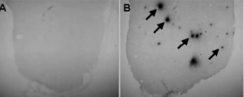 Figure  1.  Amyloid  protein  deposition  in  the  brain.  Few  amyloid  was detected in sham control group (A, X40) but diffuse amyloid  deposits  (arrows)  were  detected  in  amyloid  beta  1-42  injection  group (B, X40)