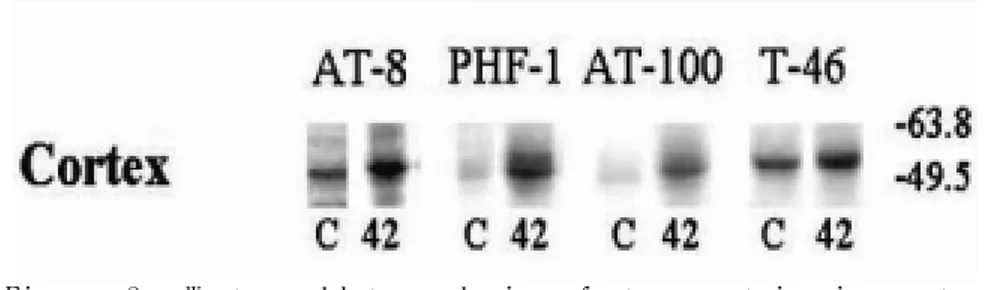 Figure  8.  Western  blot  analysis  of  tau  protein  in  cortex  Immunoblotting  analysis  showed  that  the  total  amount  of  PHF/tau  immunoreactivity was egual(T-46) but the amount of phosphorylated  tau  was  increased  at  the  cortical  extracts 