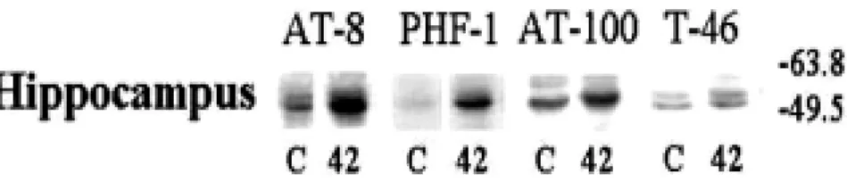 Figure  9.  Western  blot  analysis  of  tau  protein  in  hippocampus  Immunoblotting  analysis  showed  that  the  total  amount  of  PHF/tau  immunoreactivity was egual(T-46) but the amount of phosphorylated  tau  was  increased  at  the  cortical  extr