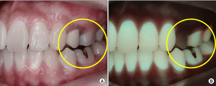 Fig.  1.  The  representative  images  used  for  pre-test  training.  (A)  White  light  image  corresponding  to  visual  inspection  with  naked  eyes