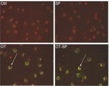 Figure  9.  Effect  of  SP600125  on  the  bacterial  invasion  into  J774A.1.  J774A.1  cells  were  treated  with  medium  (Ctrl)  or  infected  with  O