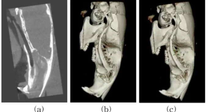 Fig. 13. Calculation of rotation angle in YZ plane. (a)  Search range and (b) search result.