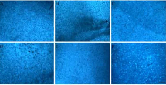 Figure  2.  Filipin  staining  of  mice  brain  tissues  (cerebral  cortex).  (A)  npc+/+  mice  (4    weeks),  (B)  npc+/-  mice  (4  weeks),  (C)  npc-/-  mice  (4  weeks),  (D)  npc+/+  mice  (8  weeks),  (E)  npc+/-  mice  (8  weeks)  and  (F)  npc-/- 