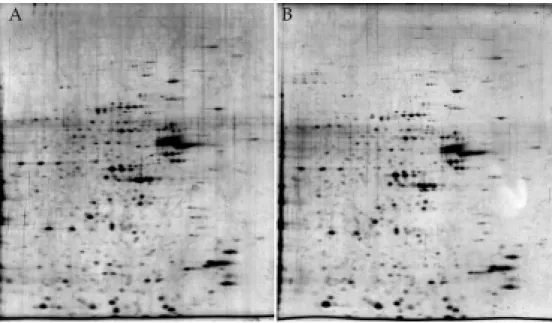 Figure  3.  Comparison  of  2-DE  maps  from  the  hippocampal  of  npc+/+  (left)  and  npc  -/-  mice  (right)