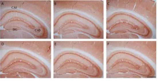 Figure  4.  Immunohistochemical  localization  of  GAT-1  in  the  hippocampal  formation