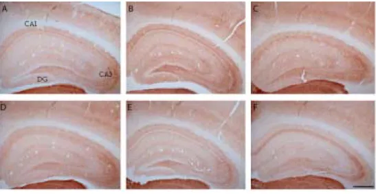 Figure  5.  Immunohistochemical  localization  of  GAT-3  in  the  hippocampal  formation