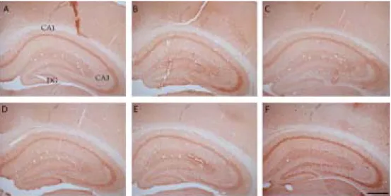 Figure  6.  Immunohistochemical  localization  of  GAD6  in  the  hippocampal  formation