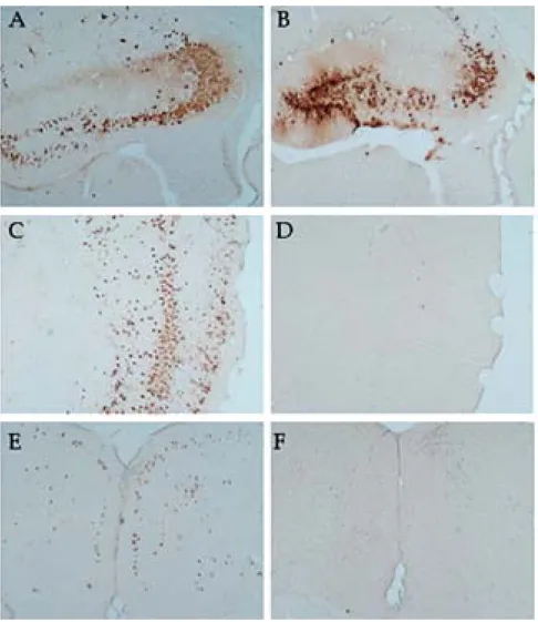 Fig. 1. PRV-immunoreactive neurons in the brain (× 40) a, b:  hippocampus; c, d: cerebral cortex; e, f : cingulated cortex