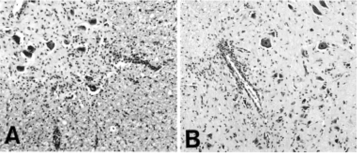 Fig.  1.    Histological  findings  in  spinal  cords  from  vehicle-treated  control  (A)  and  melatonin-treated  Lewis  rats  (B)  with  EAE  (day  14  PI)