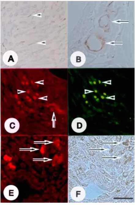 Figure  4.  Immunohistochemical  staining  of  p-ERK  in  the  sciatic  nerves  of  CFA-immunized  control  rats  (A  and  B)  and  rats  with  experimental  autoimmune  neuritis  (EAN)  (C-F)