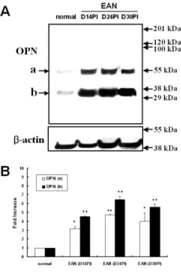 Figure  1.    Western  blot  analysis  of  OPN  in  the  sciatic  nerves  from  rats.    Normal  control  (normal),  EAN-affected  (day  14 