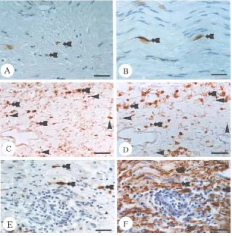 Figure  2.  Immunohistochemical  staining  for  OPN  in  the  sciatic  nerve  of  normal  rats  (A),  CFA-immunized  controls  at  day  14  post-immunization  (B),  and  rats  with  EAN  at  day  14  post-immunization  (C-F)