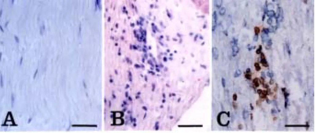 Fig.  2.    Histology  of  EAN-affected  sciatic  nerves.    Some  inflammatory  cells  were  found  in  the  sciatic  nerve  of  EAN-affected  rats  (day  13  PI)  (B),  whereas  normal  rats  were  devoid  of  inflammatory  cells  in  the  sciatic  nerve