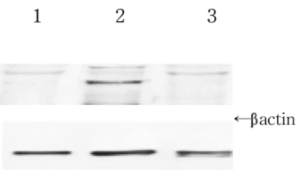Fig.  4.  A,  Western  blot  analysis  of  iNOS  in  the  sciatic  nerve  during  the  normal  (lane  1),  paralytic  (lane  2,  G3,  day  13  PI),  and  recovery  stages  (lane  3,  RO,  day  21  PI)  of  EAN  rats