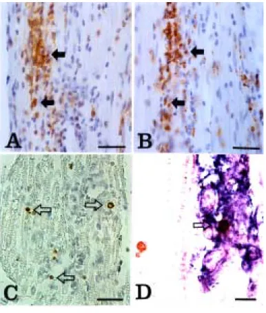 Fig.  6.    Detection  of  apoptosis  and  iNOS  expression  in  the  sciatic  nerve  of  rats  with  EAN  (G3,  day  13  PI)