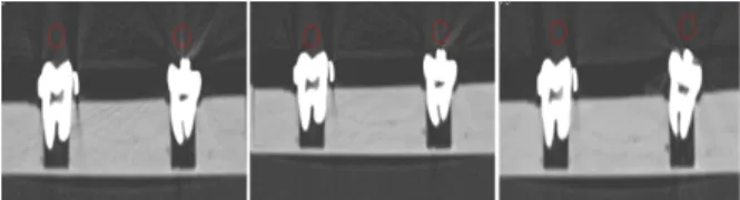 Fig.  1.  Measurement  of  CT  value  for  kVp  variation.