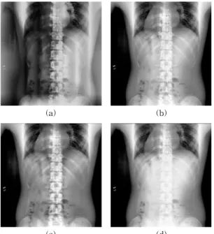 Fig. 10. Comparison of edge detection of existing CLAHE  and the proposed methods. (a) Existing Method,  (b)  Proposed  method  using  clip  limit2.