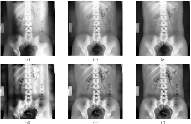 Fig.  8.  Comparison  of  existing  CLAHE  and  the  proposed  methods.  (a)  Existing  CLAHE(Section  Size:  4×4,  Threshold  parameter:  0.7),  (b)  Proposed  Interpolation  of  Histogram  map(Section  Size:  4x4,  Threshold  parameter:  0.7),  (c)  Prop