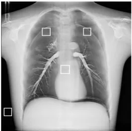 Fig.  2.  Regions  of  interest  to  measure  the  CNR  and  SNR.