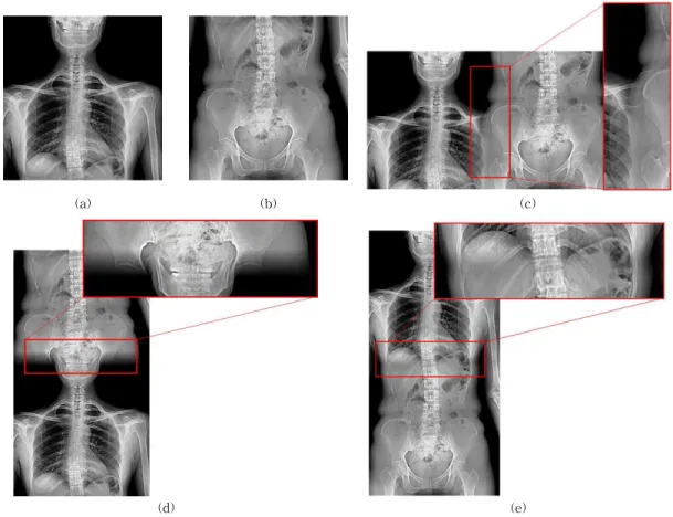 Fig.  4.  Comparison  of  the  previous  method[8]  and  the  proposed  method.  (a)  Input  image1,  (b)  Input  image2,  (c)  The  stitching  result  of  the  previous  method,  (d)  Edge  based  stitching  method,  (e)  The  stitching  result  of  the  