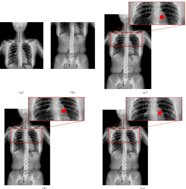 Fig.  5.  Comparison  of  the  previous  method[8]  and  the  proposed  method.  (a)  Input  image1,  (b)  Input  image2,  (c)  The  stitching  result  of  the  previous  method,  (d)  Edge  based  stitching  method,  (e)  The  stitching  result  of  the  