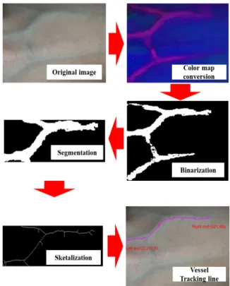 Fig.  3.  Blood  vessel  image  acquisition  setup.