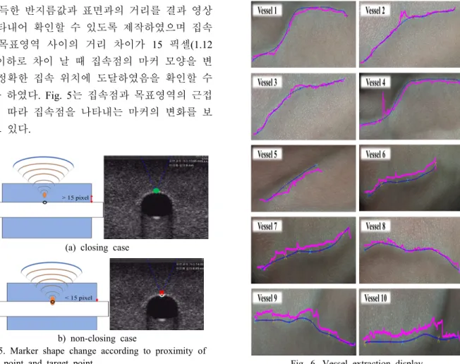 Fig.  5.  Marker  shape  change  according  to  proximity  of  focus  point  and  target  point.