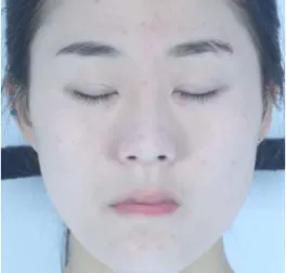 Fig. 10. Make-up simulation using Doi's method. 후의 이미지를 생성한다 . Doi의 방법은 분광기를 사 용하여  Kubelka-Munk 모델의 추정을 하여야 하지 만 , 본 연구의 방법과 비교를 위하여 RGB 색 공간에 서  KM 모델을 적용하였다