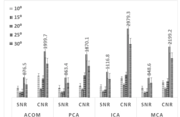 Fig.  3.  MIP  Image  of  ACOM,  PCA,  MCA  by  flip  angle  changes. 