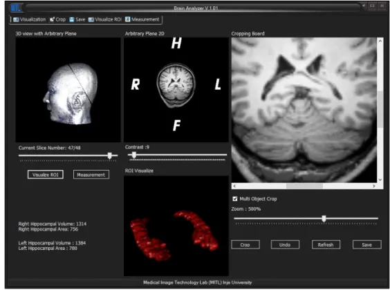 Fig. 8.  The developed 3D visualization and analyzer software tool for brain hippocampus.