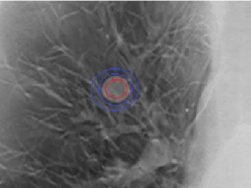 Fig.  2.  Regions  of  interest  to  measure  the  CNR  and  SNR.        (1)         (2)