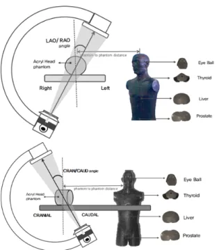 Fig.  6.  Overall  dose  measurement  process  with  various  angles  from  detector  to  X-ray  source:  (a)  LAO  and  RAO  and  (b)  Cranial  and  Caudal.