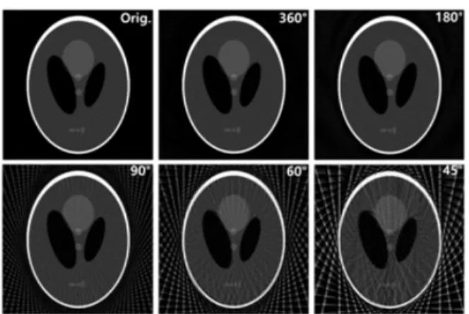 Fig.  1.  Reconstructed  image  from  various  projection  angles  by  using  FBP.  Image  degradation  such  as  streak  artifact  is  obviously  appeared  at  fewer  projections  due  to  the  missing  data.