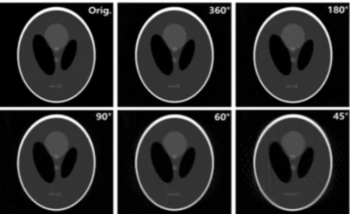 Fig.  3.  Phantom  images  were  reconstructed  by  using  linear  interpolation.  Streak  artifacts  in  the  image  were  still  appeared.