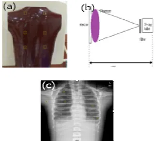 Fig. 2. Insert the glass dosimeter in the rando  phantom(a), The study was chest PA with fixed  conditions FFD 180 cm, 120 kVp, 6.3 mAs(b), ROI 