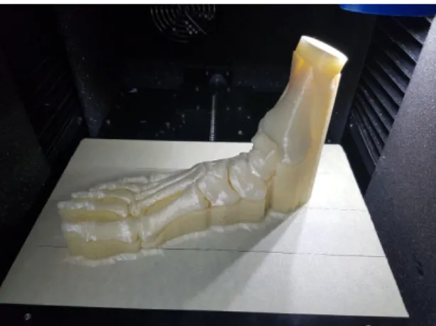 Fig.  5.  3D  Bone  model  of  whole  foot  with  support.