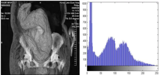 Fig. 7. Original medical image and its Histogram.