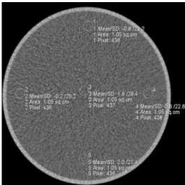 Fig.  2.  ROI  on  Phantom  Image.