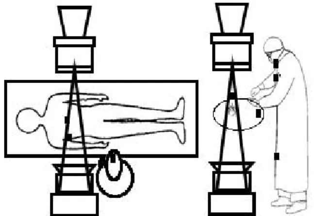 Fig.  1.  Electronic  dosimeter  measurement  placed  during  percutaneous  vertebroplasty