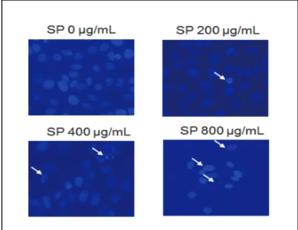 Fig.  3.  Effect  of  SP  extract  on  apoptosis-related molecules  in  MCF-7  breast  cancer  cells  for  72  h